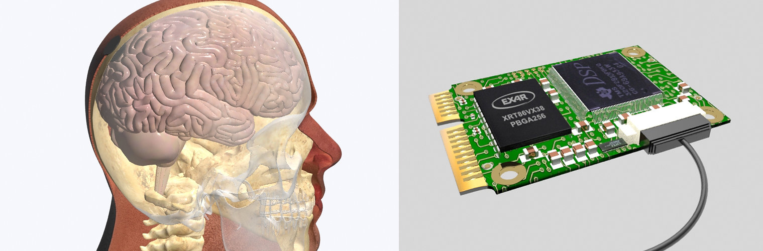 Technical medical illustration